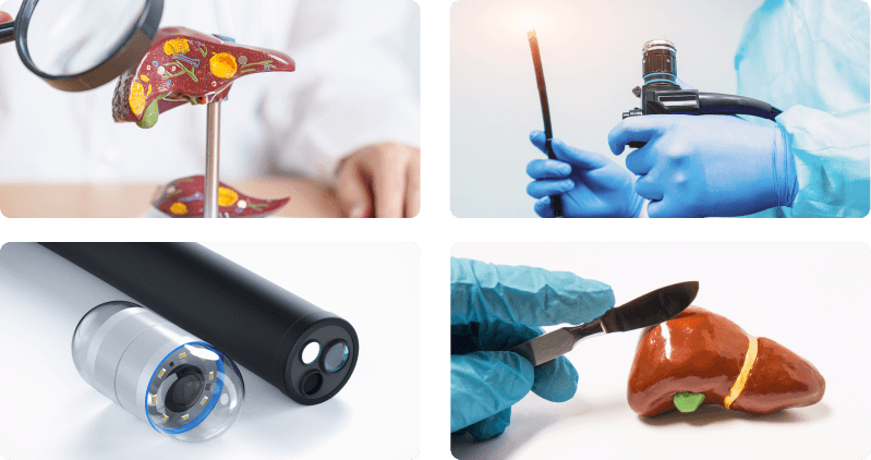 Featured Services of Our Gastroenterology Clinic in Singapore